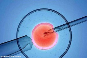 关于代生儿子包性别